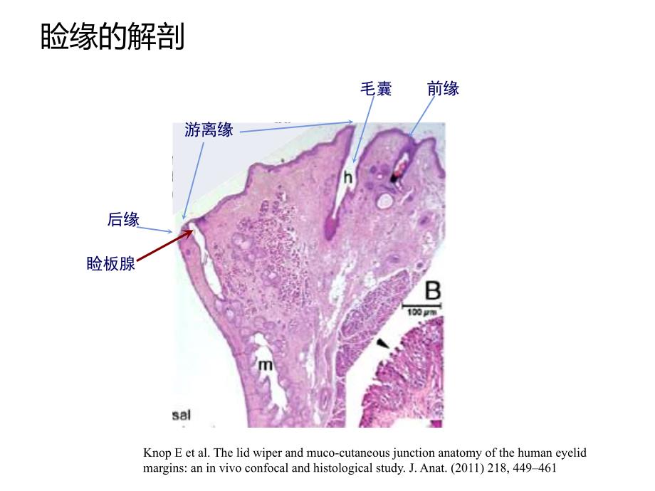 睑缘解剖与睑缘炎病理机理.ppt_第3页