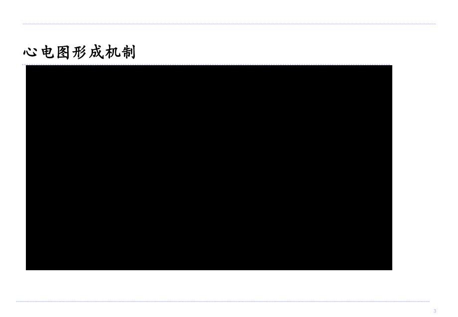 常见异常心电图(修改版).ppt_第3页