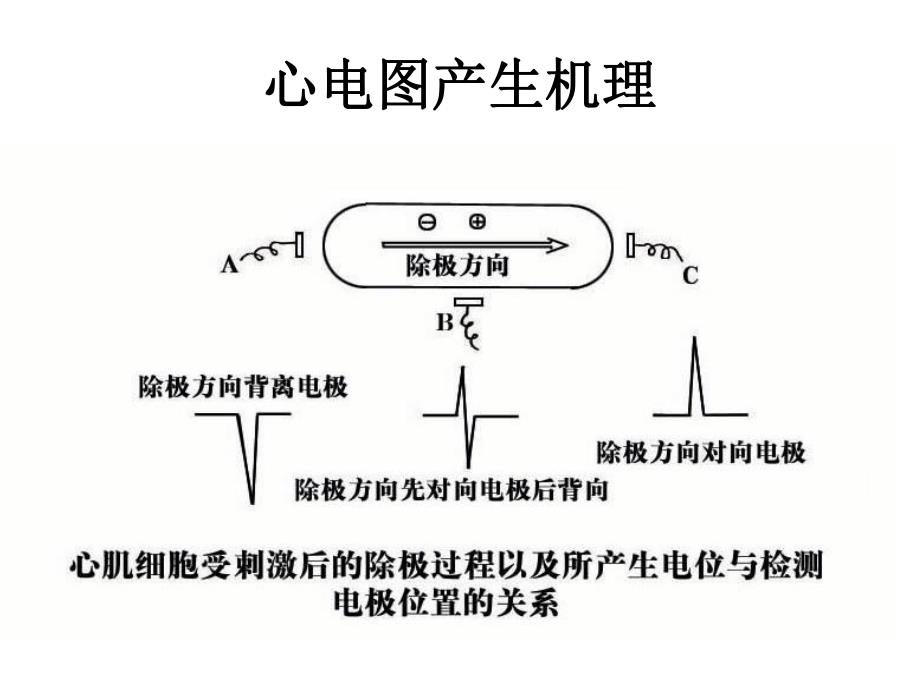 围术期常见的异常心电图分析.ppt_第2页