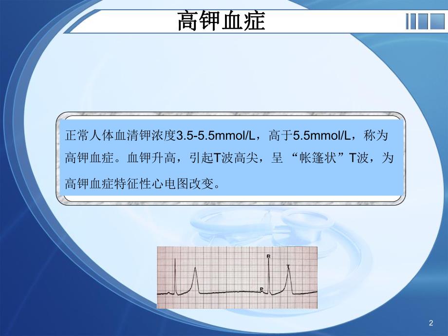 电解质紊乱心电图.ppt_第2页