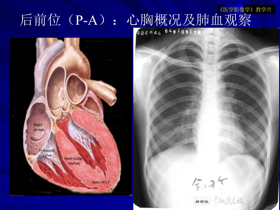 医学影像学教学片循环1.ppt_第3页