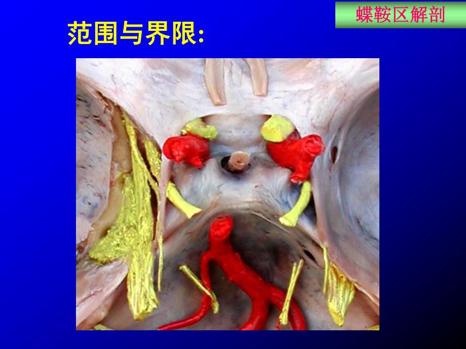 蝶鞍区应用解剖.ppt_第2页