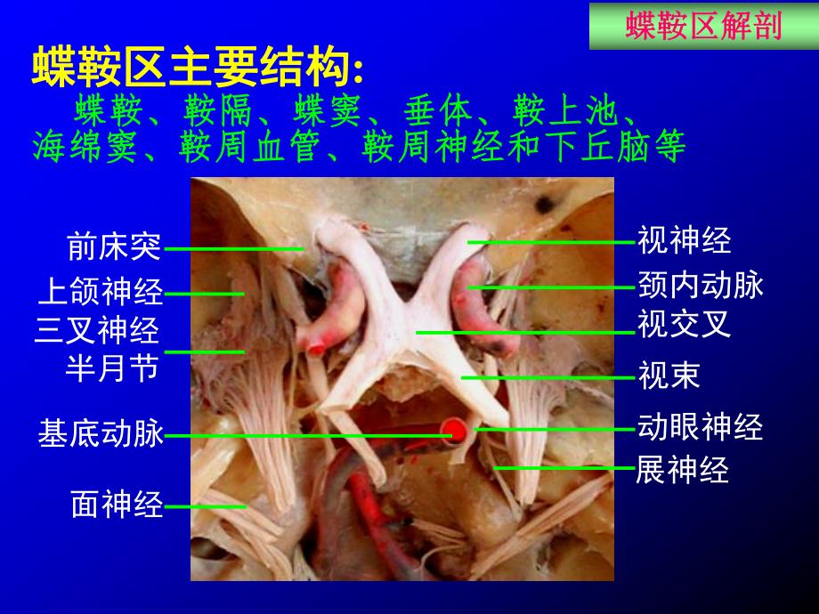 蝶鞍区应用解剖.ppt_第3页