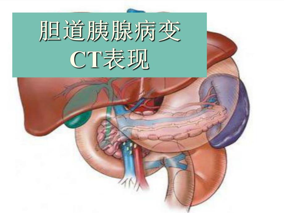 胆胰腺CT.ppt_第1页