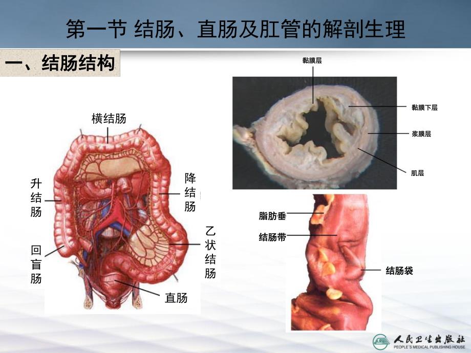 结肠直肠与肛管疾病幻灯片.ppt_第3页