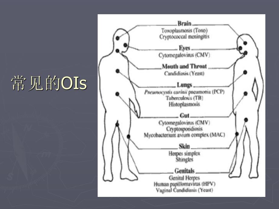 艾滋病的肺部并发症.ppt_第2页