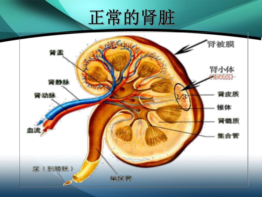 肾囊肿 幻灯片.ppt.ppt_第2页