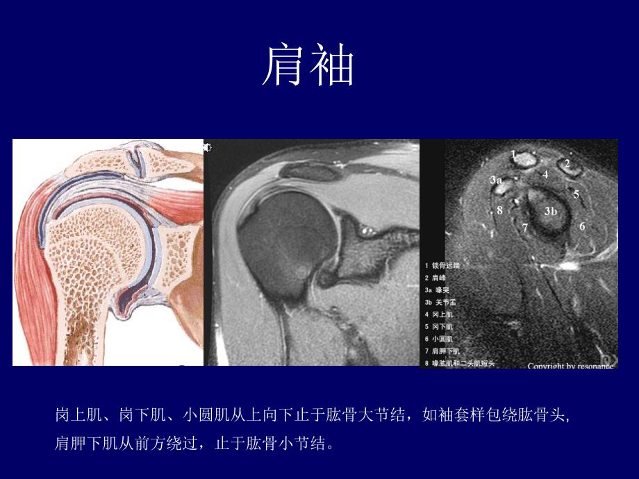 肩关节MRI.ppt_第3页