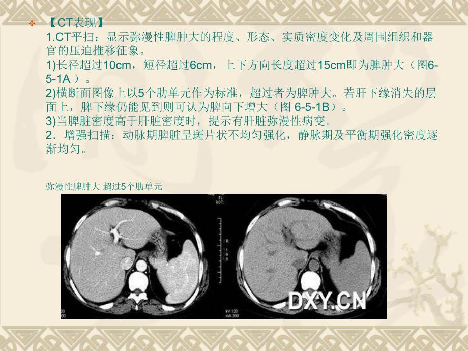 脾脏的正常与异常CT表现.ppt.ppt_第3页