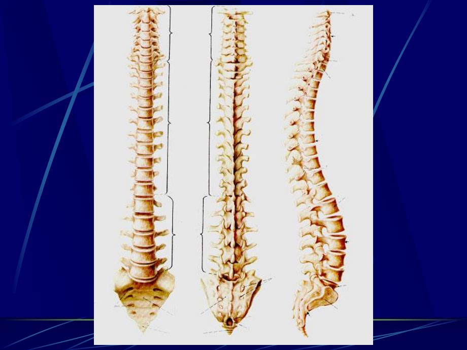 脊柱区断层解剖及CT、MRI.ppt_第3页