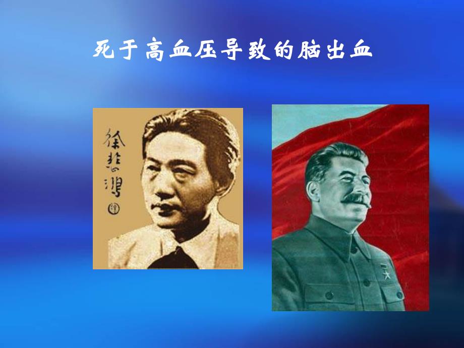 心脑血管及高血压病预防.ppt_第3页