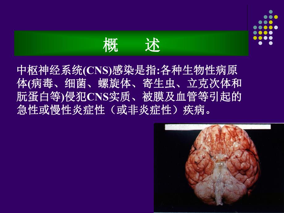 中枢神经系统感染疾病.ppt_第3页