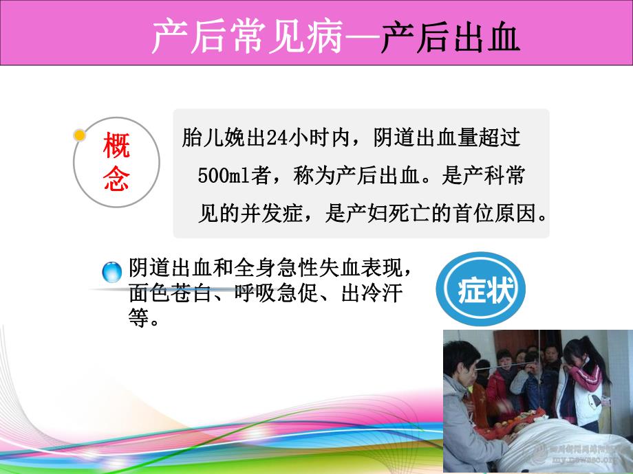 产后常见疾病的预防.ppt_第2页