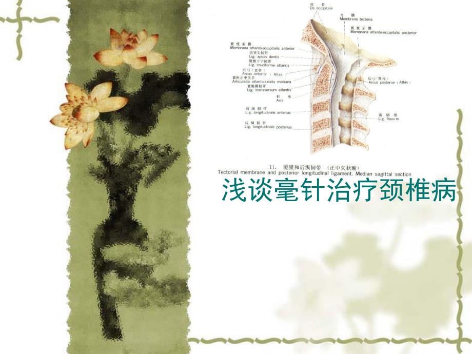 [资料]浅谈针灸治疗颈椎病.ppt_第1页