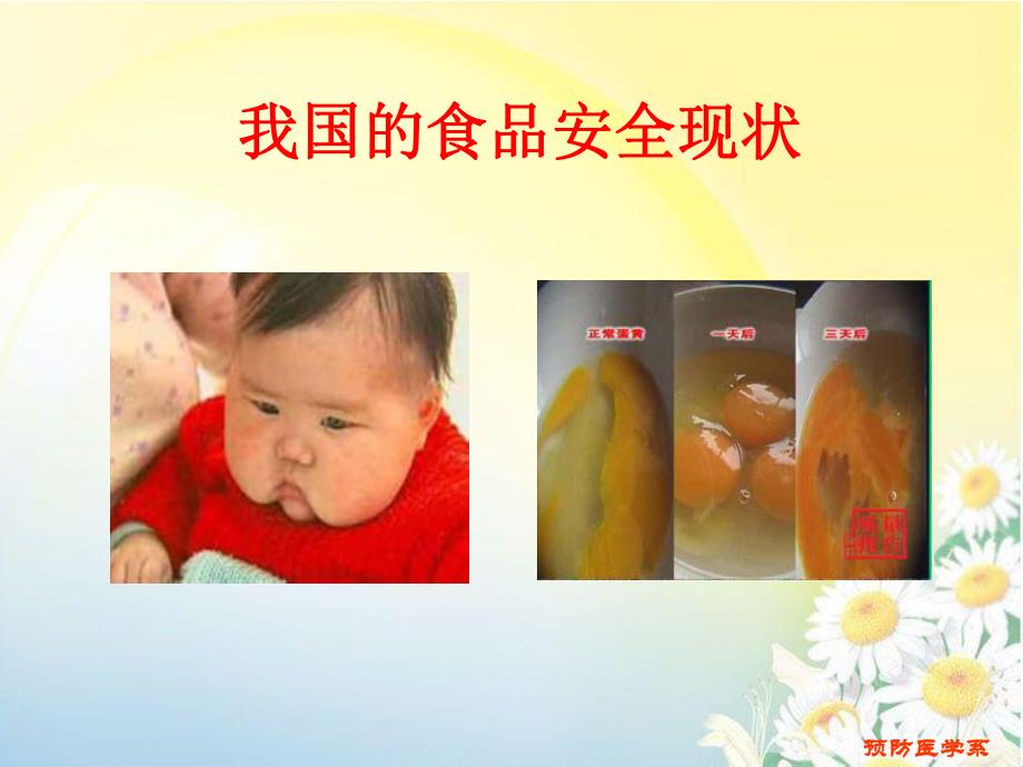 预防医学食品安全.ppt_第2页