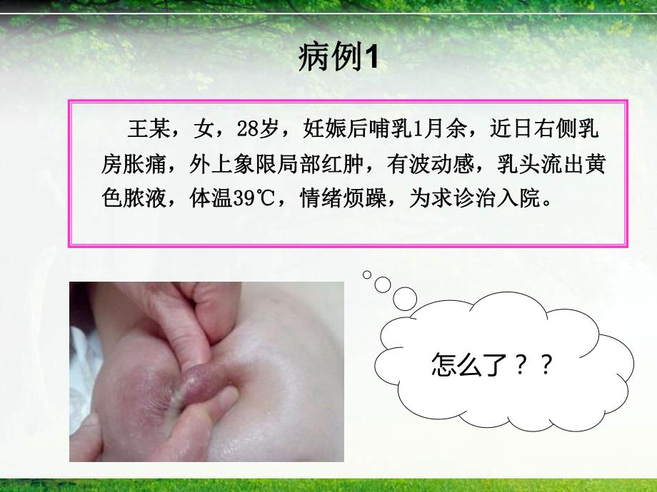 急性乳腺炎.ppt_第3页