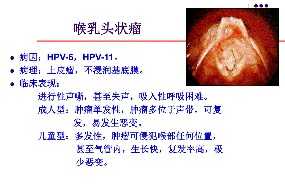 【精品】喉部肿瘤39.ppt_第3页