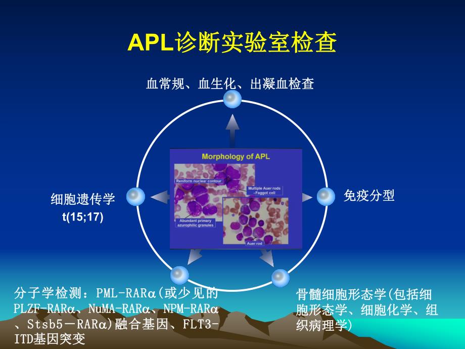 急性早幼粒细胞白血病.ppt_第2页