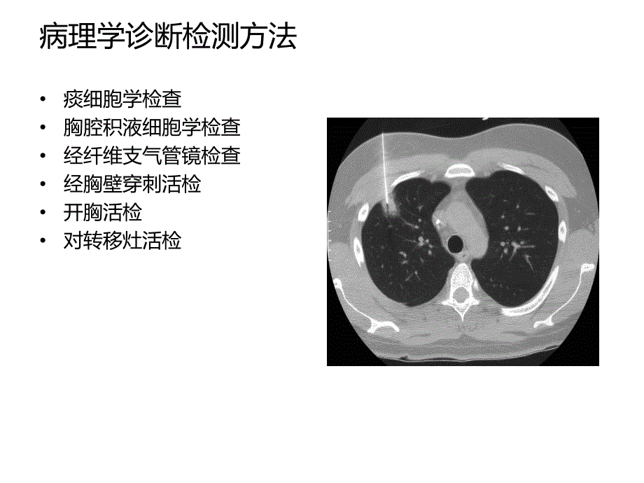 肺癌患者围术期处理新进展.ppt_第3页