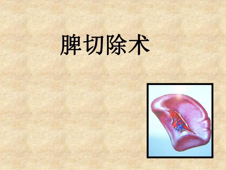 脾切除术.ppt_第1页