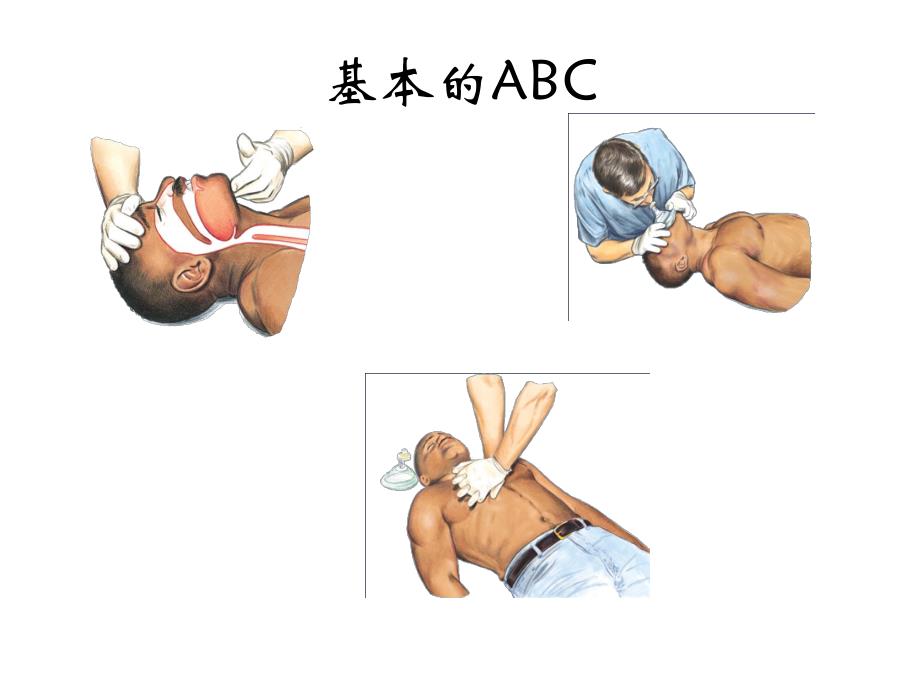 医疗急救物品及知识培训.ppt_第3页