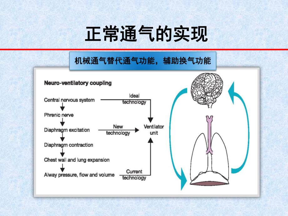 儿童机械通气..ppt_第2页