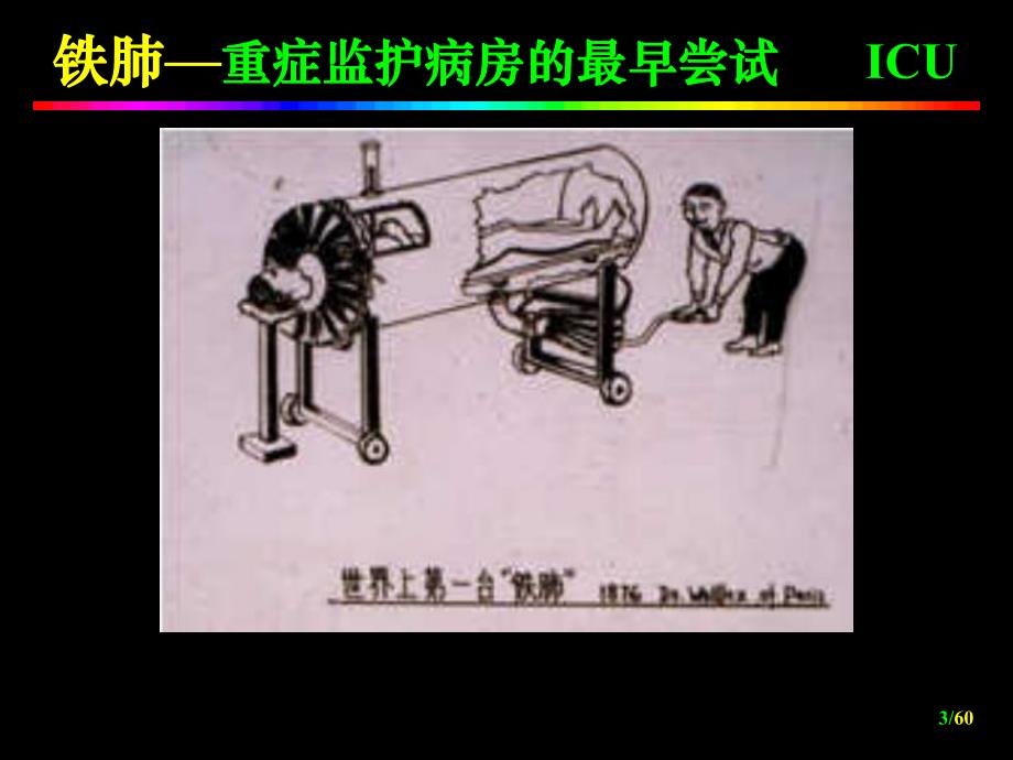 ICU重症监护.ppt_第3页