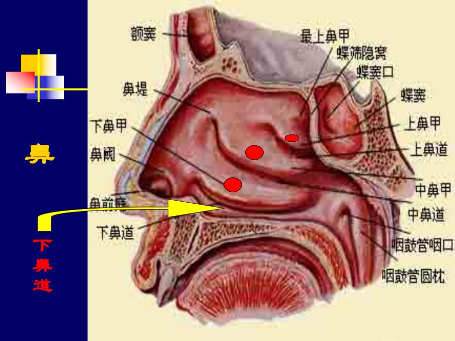 急诊人工气道开放与管理.ppt_第3页