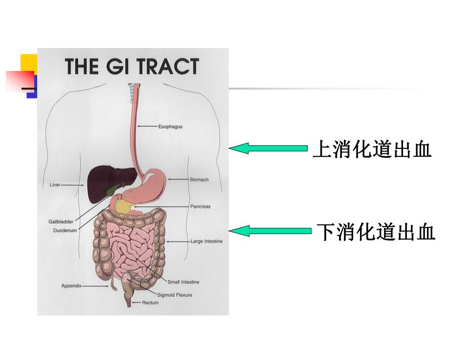 第十三节上消化道大出血.ppt_第3页