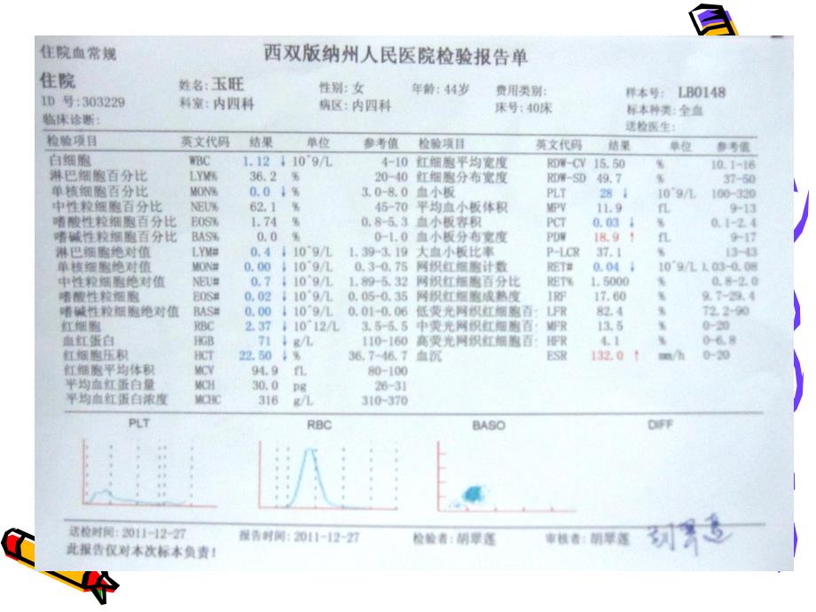 如何解读血常规和凝血分析.ppt_第2页