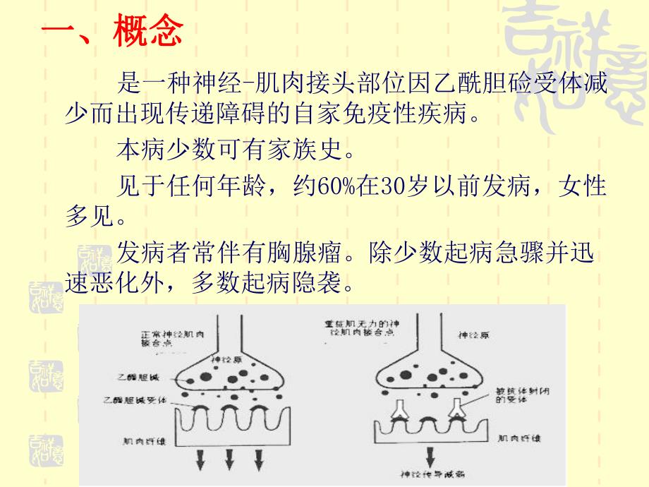 重症肌无力的护理hh.ppt_第2页