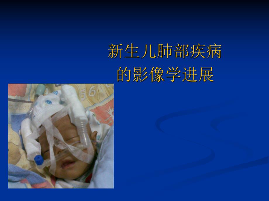 Xray在新生儿的临床应用.ppt_第1页