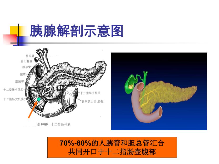 急性胰腺炎诊治.ppt.ppt_第3页