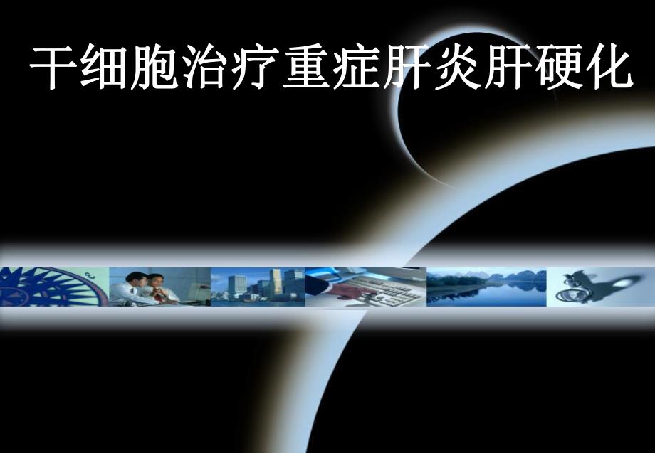 干细胞治疗重症肝炎肝硬化.ppt_第1页