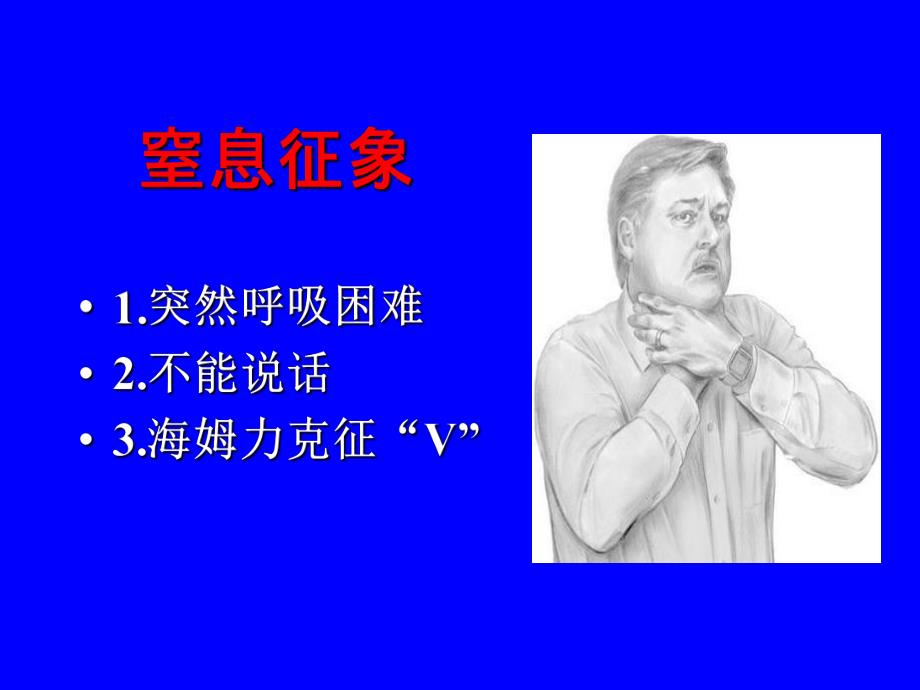 标准呼吸道梗阻救治.ppt_第2页