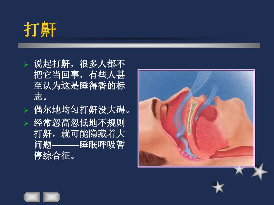 睡眠呼吸暂停综合征的多系统影响.ppt_第2页