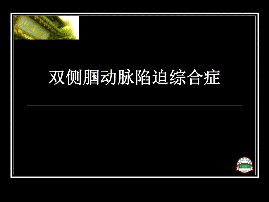 双侧腘动脉陷迫综合症.ppt_第1页