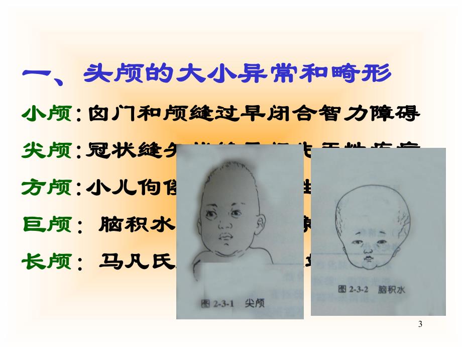 头颈胸部体格检查2学时.ppt_第3页