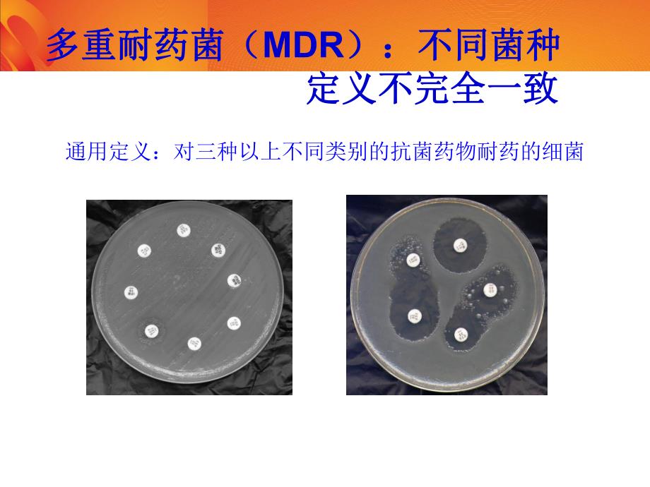 多重耐药革兰阴性菌感染与治疗.ppt_第2页