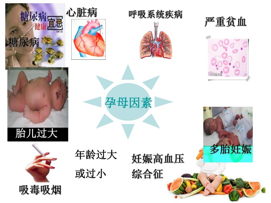 新生儿缺血缺氧性脑病护理.ppt_第3页