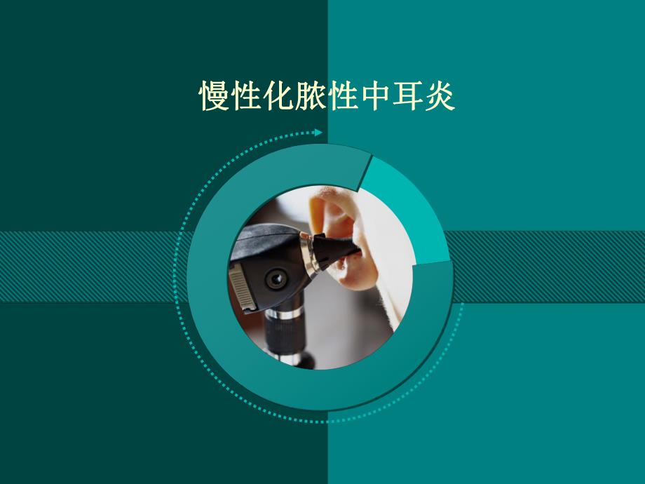 胆脂瘤型中耳炎.ppt_第1页