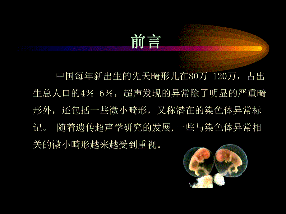 产科超声常见微小异常报告解读.ppt_第2页