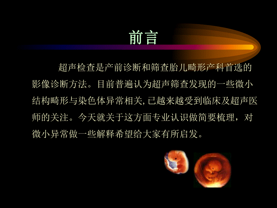 产科超声常见微小异常报告解读.ppt_第3页