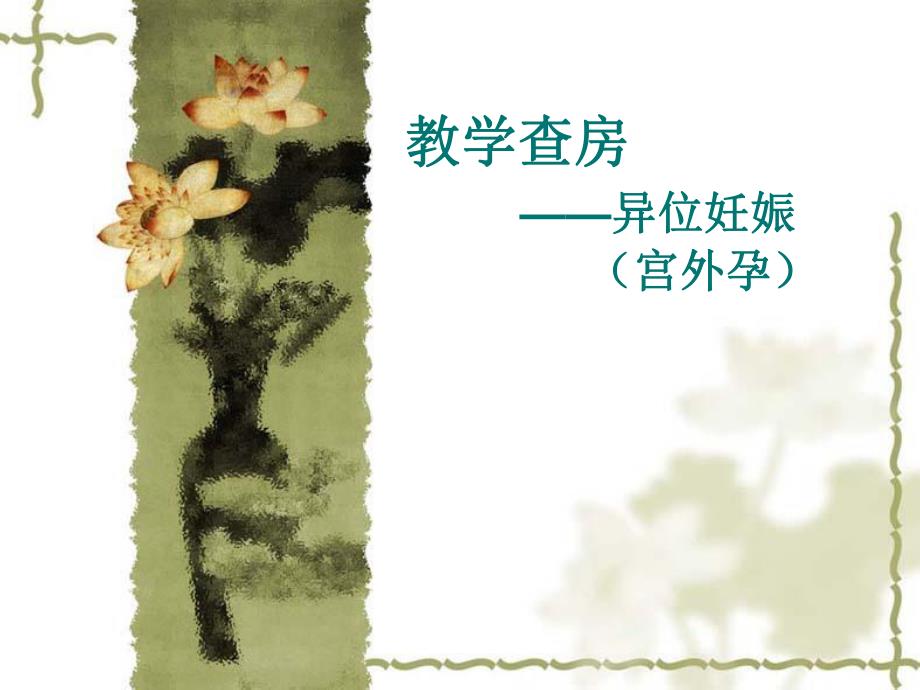 异位妊娠(PPT59).ppt_第1页