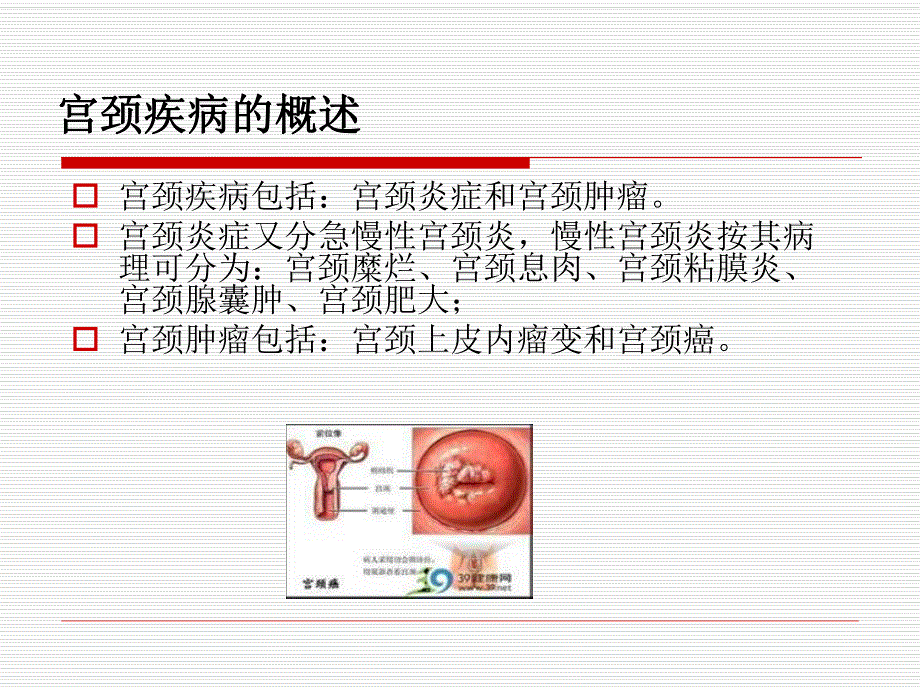 宫颈癌的预防与保健.ppt.ppt_第3页