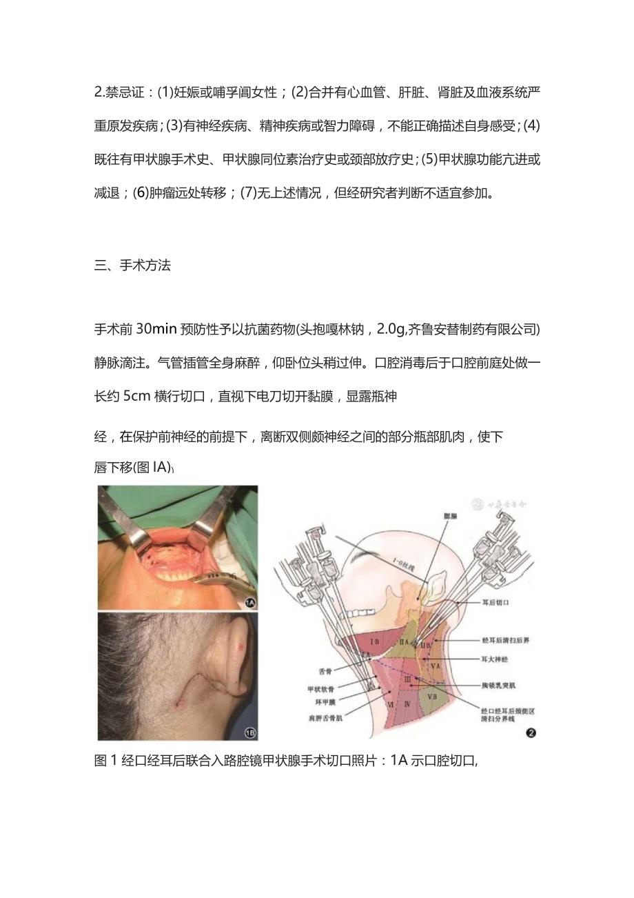 2023经口经耳后联合入路腔镜甲状腺手术临床分析.docx_第2页