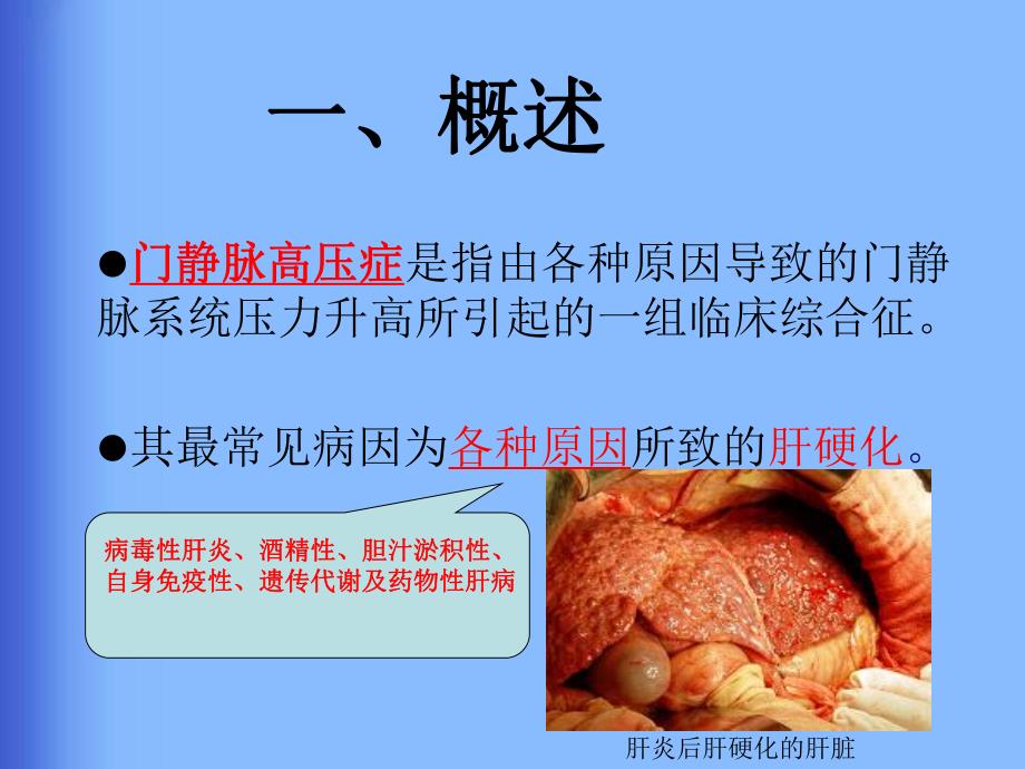 肝硬化门静脉高压食管胃静脉曲张出血的防治共识.ppt_第2页