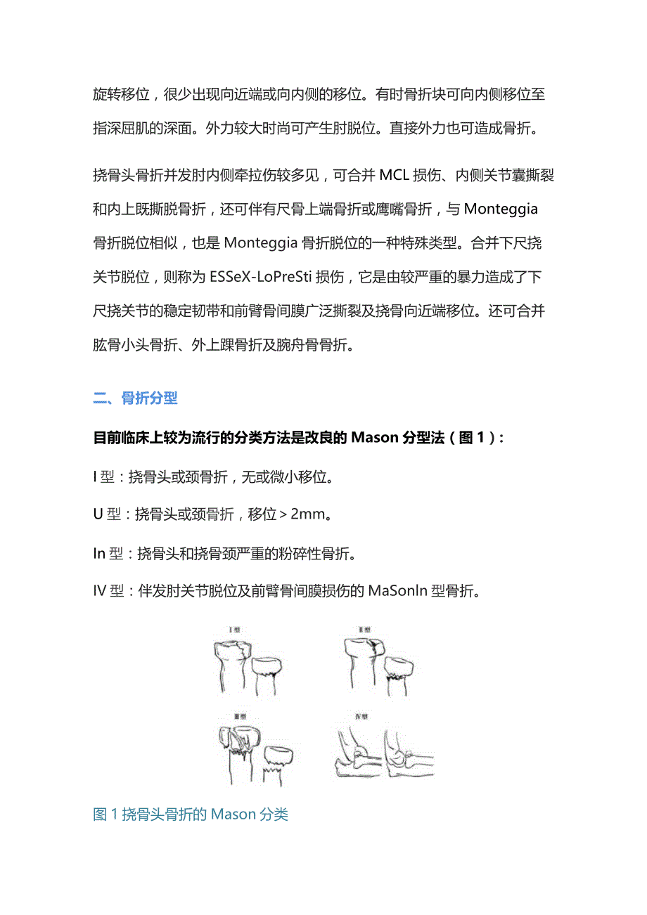 2023桡骨头骨折的诊治.docx_第2页