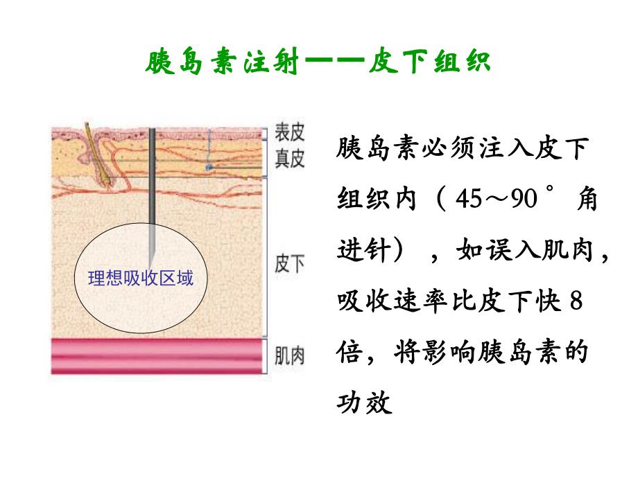 胰岛素注射及注意事项.ppt_第2页