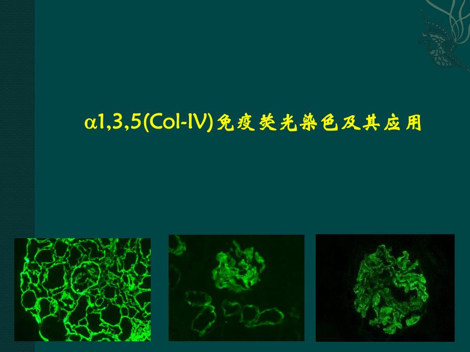 肾脏病理.ppt_第1页